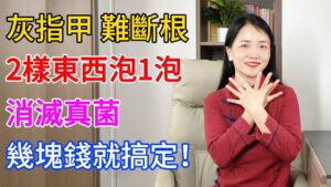 灰指甲、腳氣有救了！李曉老師：醋泡花椒，每天20分鐘，陳年舊甲變新甲，全家不再怕傳染！