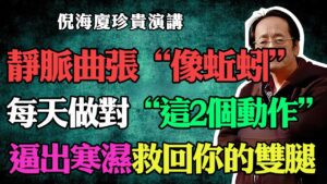 倪海廈親授：2招告別靜脈曲張！免手術免襪，排出寒濕救雙腿！